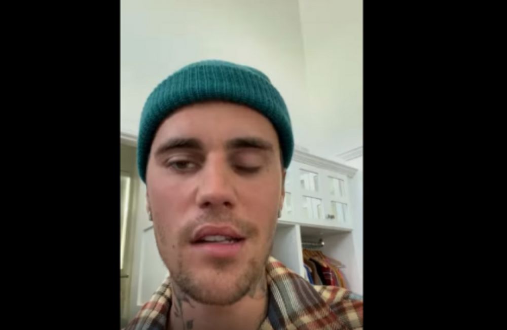 Penyanyi Justin Bieber mengaku dirinya mengidap Ramsay Hunt syndrome yang menyebabkan wajahnya lumpuh separuh. 